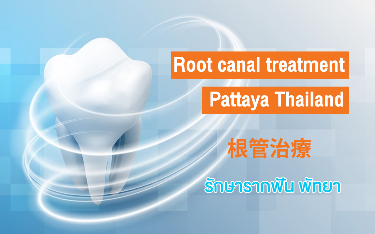 Root Canal Treatment Pattaya Dental Center, Dental Clinic Pattaya, Best Dentists @ Beach, Root Canals in Pattaya, Dentist Pattaya, Thailand