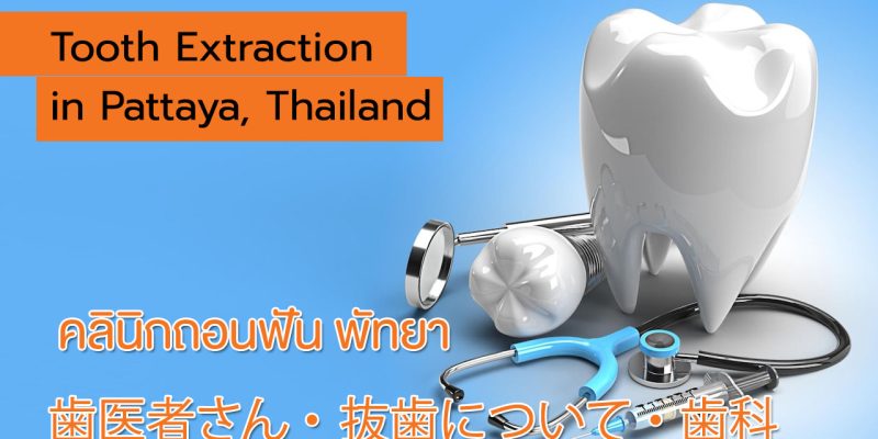 Pattaya City Dental Center, Tooth removal for toothaches and poor prognoses teeth, คลินิกถอนฟัน พัทยา, ถอนฟันใกล้ฉัน, ถอนฟันผุ, ถอนฟันคุด